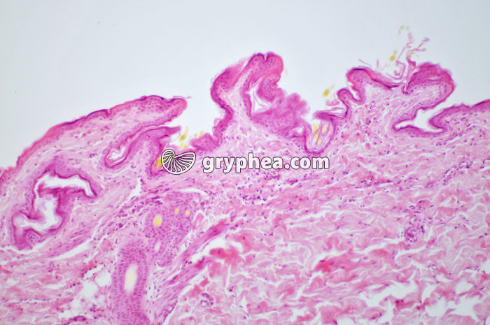 Glande mammaire inactive CT x40 - gryphea.com